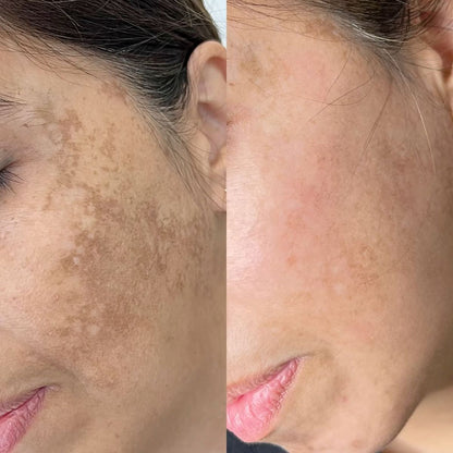 POUQUR Orange Enzyme Exfoliating & Brightening Gel