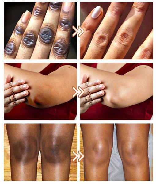 POUQUR Orange Enzyme Exfoliating &amp; Brightening Gel