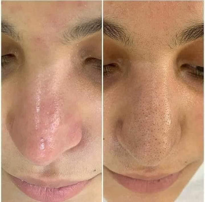 POUQUR Orange Enzyme Exfoliating & Brightening Gel