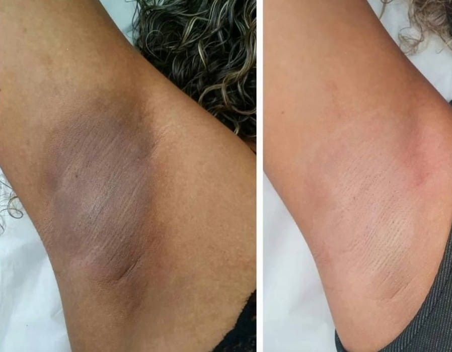 POUQUR Orange Enzyme Exfoliating & Brightening Gel